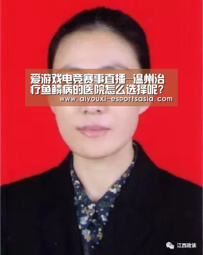 爱游戏电竞赛事直播-温州治疗鱼鳞病的医院怎么选择呢?(图2) 爱游戏电竞赛事直播